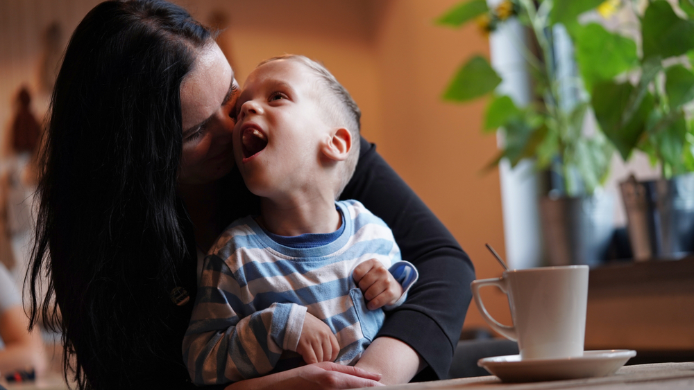 Close,Up,Portrait,Of,A,Little,Boy,With,Special,Needs